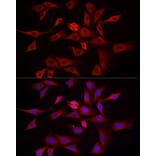 Immunofluorescence - Anti-DRP1 Antibody (A91310) - Antibodies.com