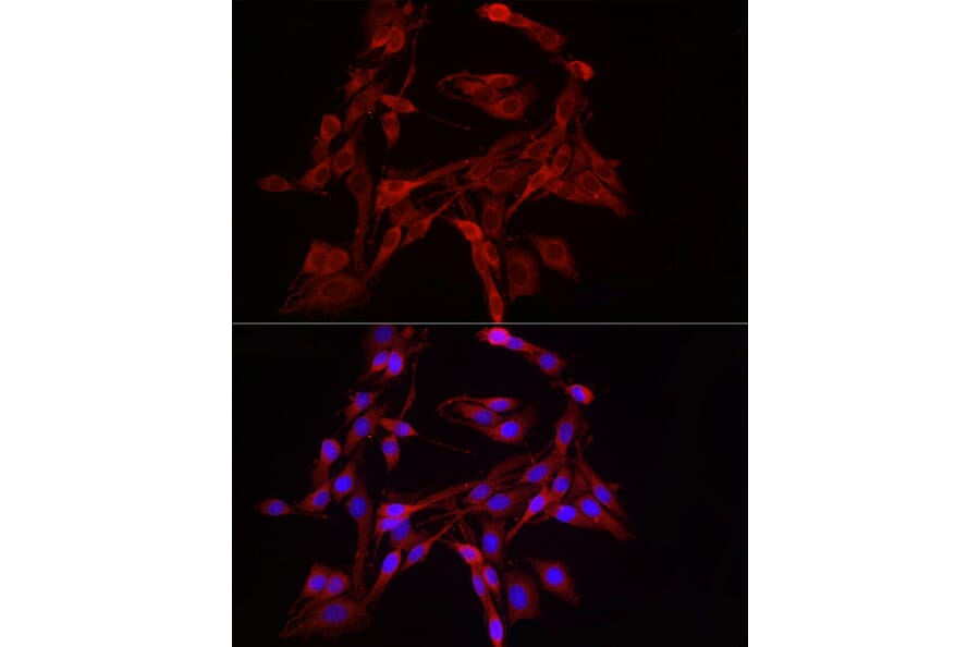 Immunofluorescence - Anti-DRP1 Antibody (A91310) - Antibodies.com