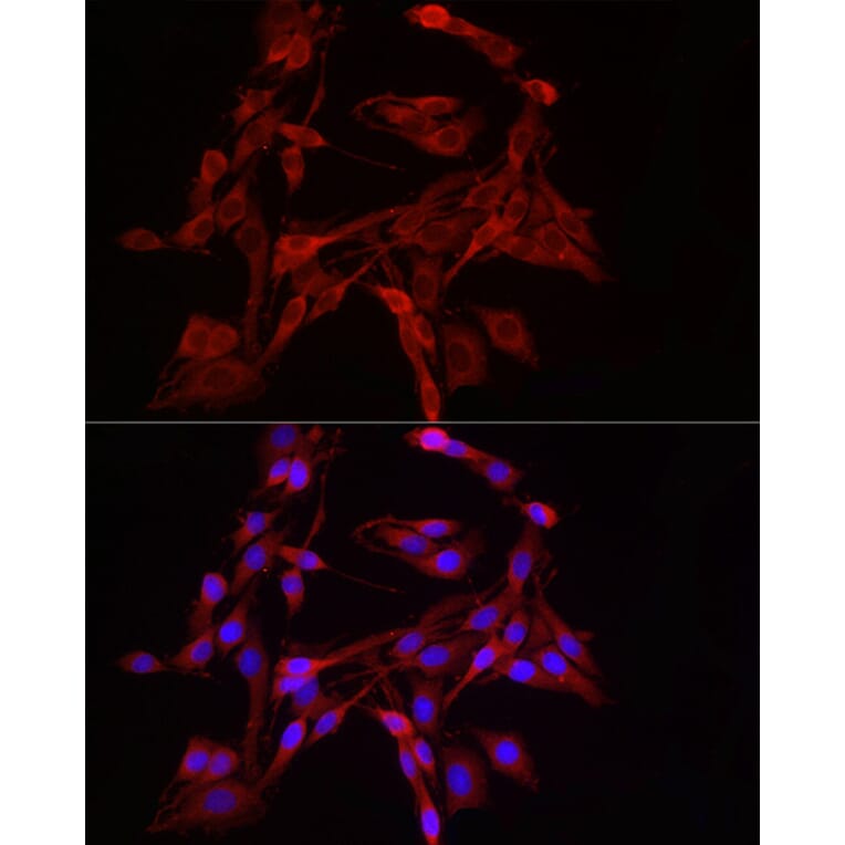 Immunofluorescence - Anti-DRP1 Antibody (A91310) - Antibodies.com