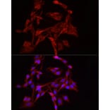 Immunofluorescence - Anti-DRP1 Antibody (A91310) - Antibodies.com