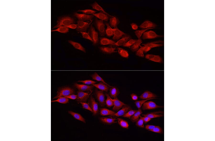 Immunofluorescence - Anti-DRP1 Antibody (A91310) - Antibodies.com