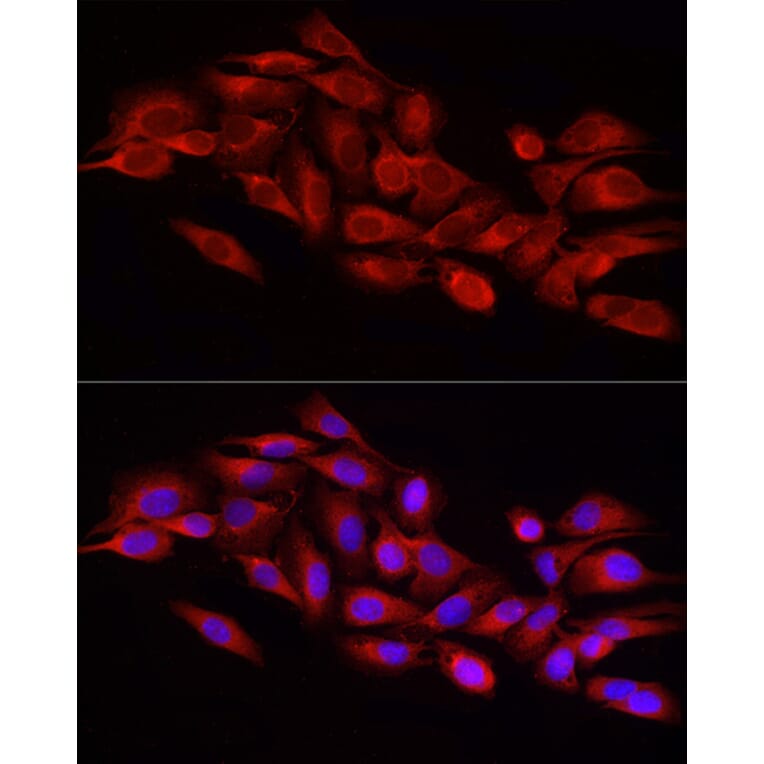 Immunofluorescence - Anti-DRP1 Antibody (A91310) - Antibodies.com