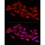 Immunofluorescence - Anti-DRP1 Antibody (A91310) - Antibodies.com