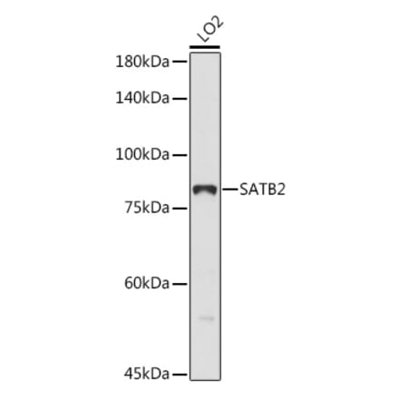 Western Blot - Anti-SATB2 Antibody (A91312) - Antibodies.com
