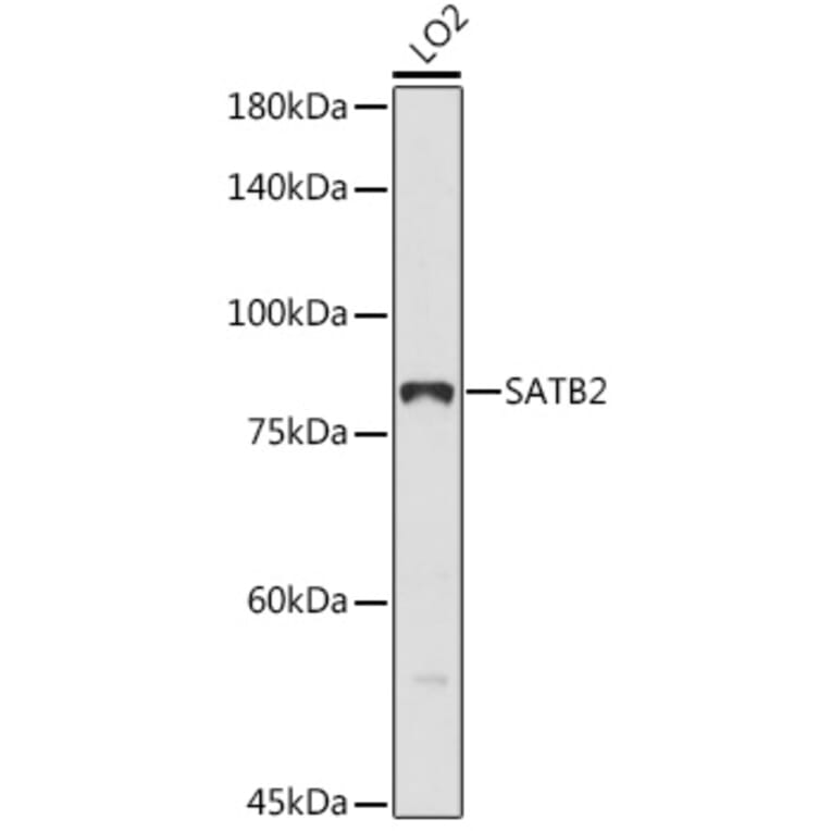 Western Blot - Anti-SATB2 Antibody (A91312) - Antibodies.com