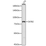 Western Blot - Anti-SATB2 Antibody (A91312) - Antibodies.com