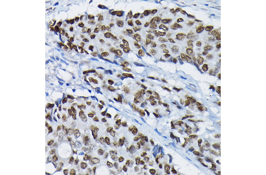 Immunohistochemistry - Anti-SATB2 Antibody (A91312) - Antibodies.com