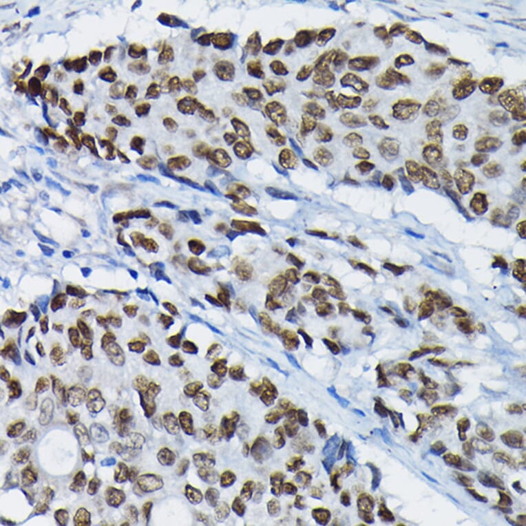 Immunohistochemistry - Anti-SATB2 Antibody (A91312) - Antibodies.com