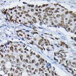 Immunohistochemistry - Anti-SATB2 Antibody (A91312) - Antibodies.com