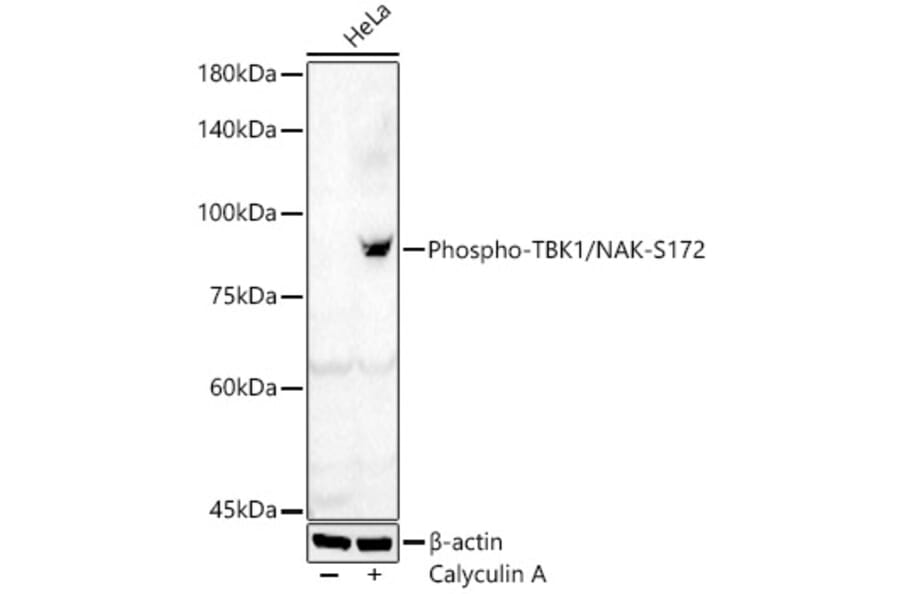 Western Blot - Anti-NAK/TBK1 (phospho Ser172) Antibody (A91313) - Antibodies.com