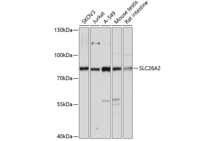 Western Blot - Anti-SLC26A2/DTD Antibody (A91314) - Antibodies.com