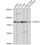 Western Blot - Anti-SLC26A2/DTD Antibody (A91314) - Antibodies.com