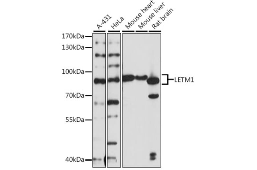 Western Blot - Anti-LETM1 Antibody (A91315) - Antibodies.com