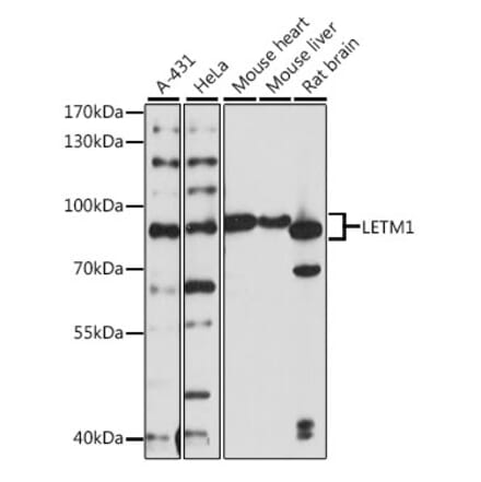 Western Blot - Anti-LETM1 Antibody (A91315) - Antibodies.com