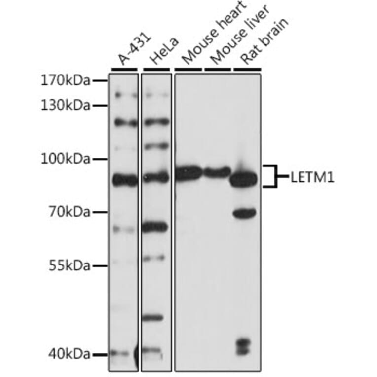 Western Blot - Anti-LETM1 Antibody (A91315) - Antibodies.com