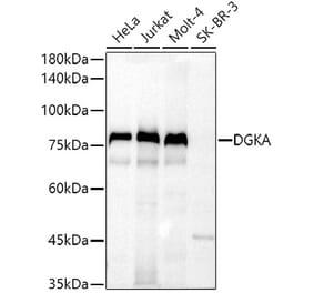 Western Blot - Anti-DGKA Antibody (A91316) - Antibodies.com