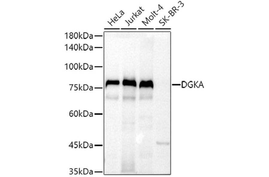 Western Blot - Anti-DGKA Antibody (A91316) - Antibodies.com