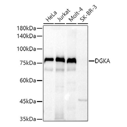 Western Blot - Anti-DGKA Antibody (A91316) - Antibodies.com