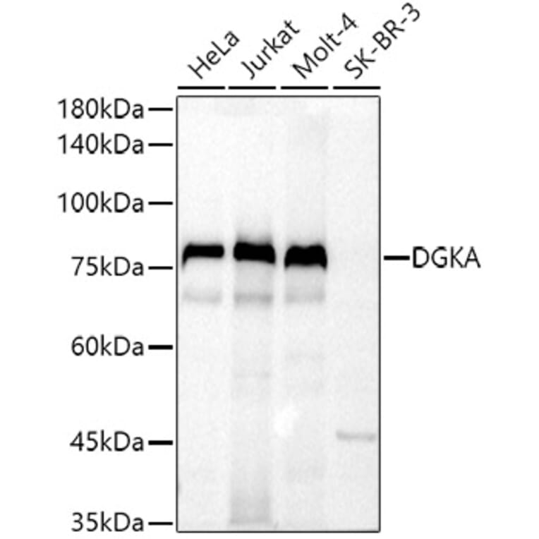 Western Blot - Anti-DGKA Antibody (A91316) - Antibodies.com