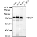 Western Blot - Anti-DGKA Antibody (A91316) - Antibodies.com