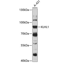 Western Blot - Anti-KLHL1 Antibody (A91317) - Antibodies.com