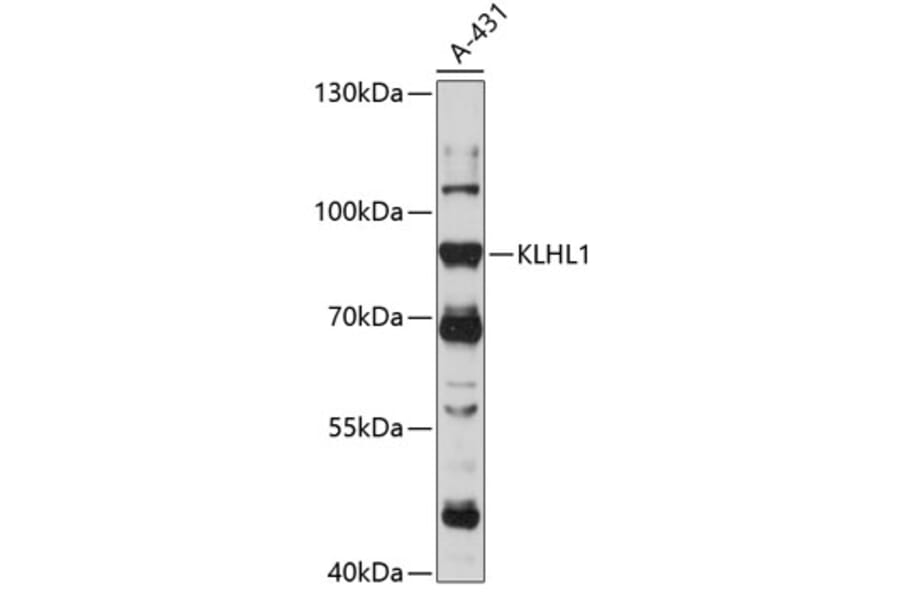 Western Blot - Anti-KLHL1 Antibody (A91317) - Antibodies.com