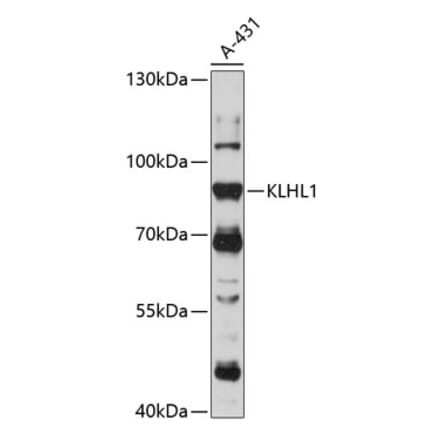 Western Blot - Anti-KLHL1 Antibody (A91317) - Antibodies.com