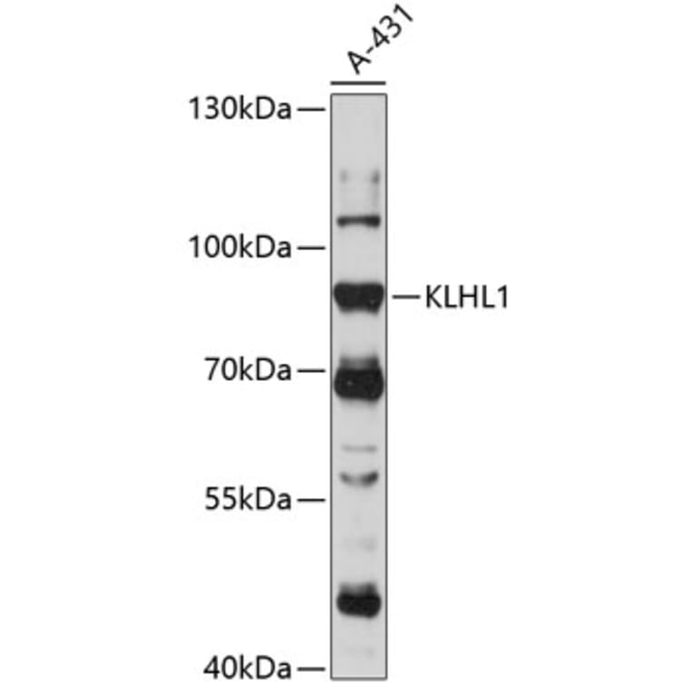 Western Blot - Anti-KLHL1 Antibody (A91317) - Antibodies.com