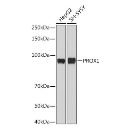 Western Blot - Anti-PROX1 Antibody (A91318) - Antibodies.com