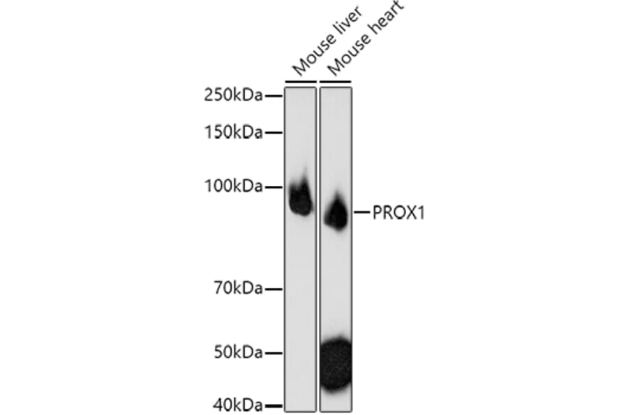 Western Blot - Anti-PROX1 Antibody (A91318) - Antibodies.com