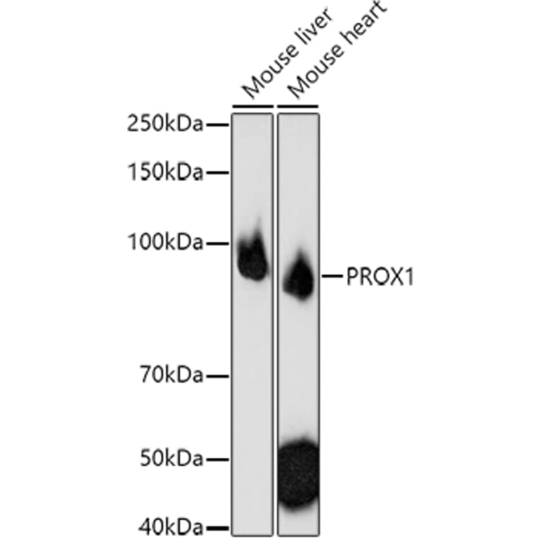 Western Blot - Anti-PROX1 Antibody (A91318) - Antibodies.com