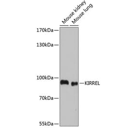 Western Blot - Anti-KIRREL Antibody (A91319) - Antibodies.com