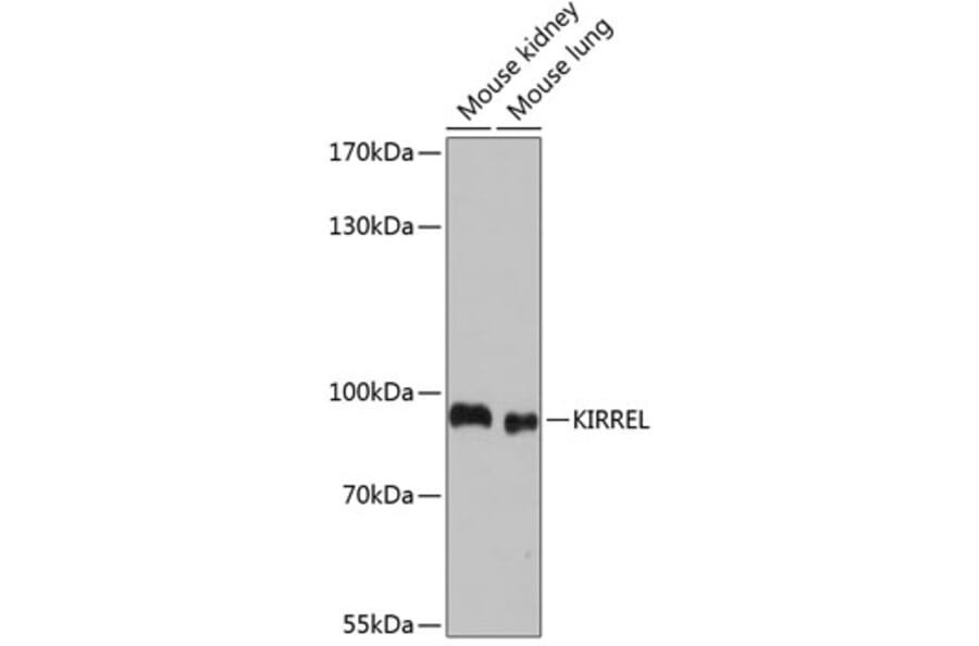 Western Blot - Anti-KIRREL Antibody (A91319) - Antibodies.com