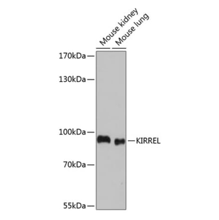 Western Blot - Anti-KIRREL Antibody (A91319) - Antibodies.com