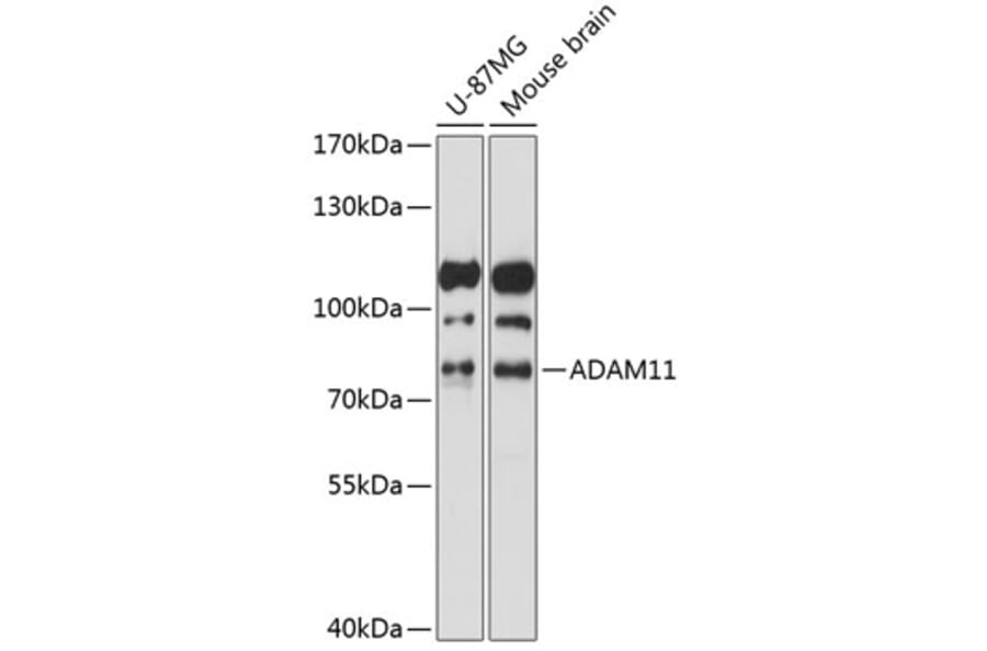 Western Blot - Anti-ADAM11 Antibody (A91320) - Antibodies.com
