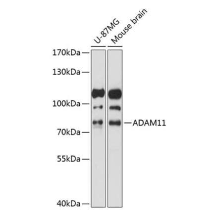 Western Blot - Anti-ADAM11 Antibody (A91320) - Antibodies.com