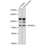 Western Blot - Anti-ADAM11 Antibody (A91320) - Antibodies.com