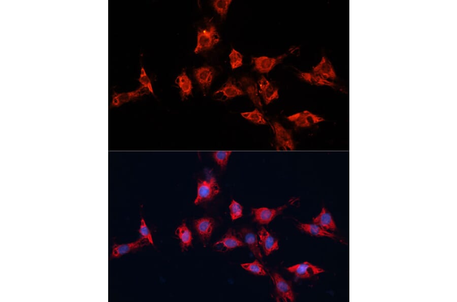 Immunofluorescence - Anti-ADAM11 Antibody (A91320) - Antibodies.com