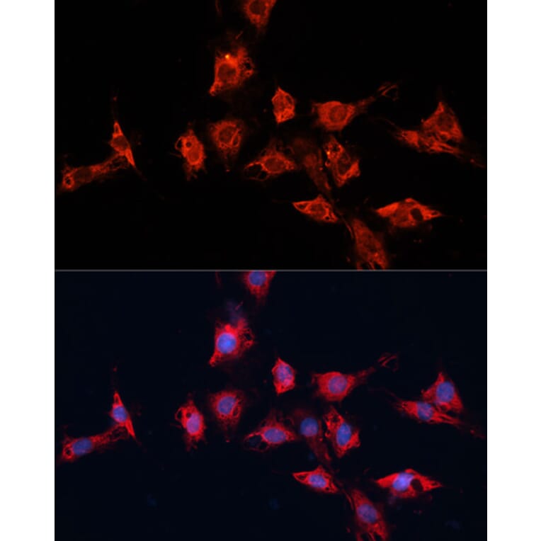 Immunofluorescence - Anti-ADAM11 Antibody (A91320) - Antibodies.com