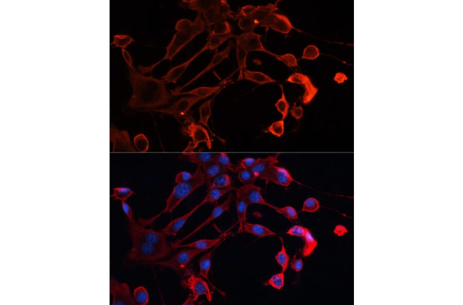 Immunofluorescence - Anti-ADAM11 Antibody (A91320) - Antibodies.com