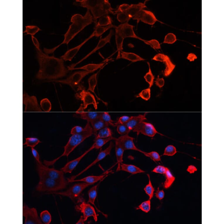 Immunofluorescence - Anti-ADAM11 Antibody (A91320) - Antibodies.com