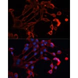 Immunofluorescence - Anti-ADAM11 Antibody (A91320) - Antibodies.com