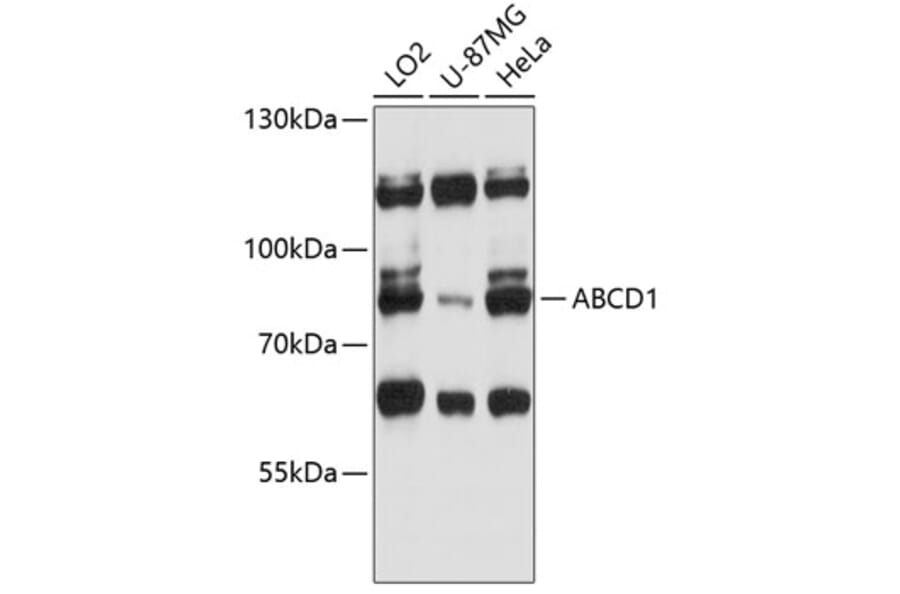 Western Blot - Anti-ABCD1/ALD Antibody (A91321) - Antibodies.com