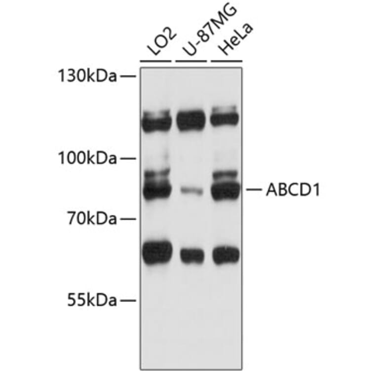 Western Blot - Anti-ABCD1/ALD Antibody (A91321) - Antibodies.com