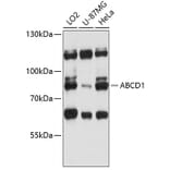 Western Blot - Anti-ABCD1/ALD Antibody (A91321) - Antibodies.com