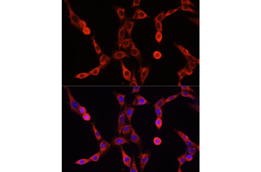 Immunofluorescence - Anti-ABCD1/ALD Antibody (A91321) - Antibodies.com