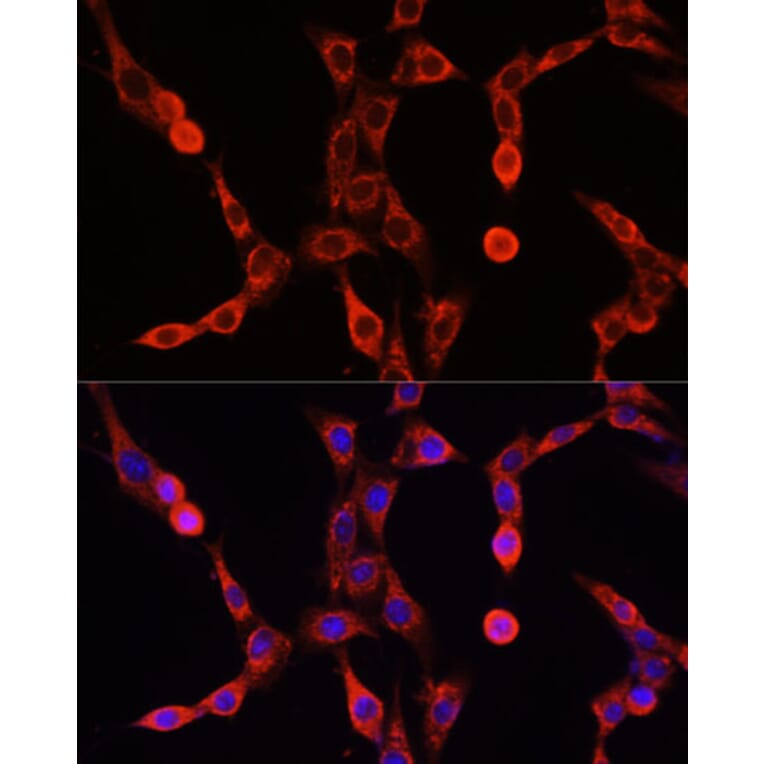Immunofluorescence - Anti-ABCD1/ALD Antibody (A91321) - Antibodies.com