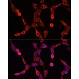 Immunofluorescence - Anti-ABCD1/ALD Antibody (A91321) - Antibodies.com