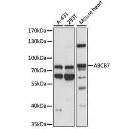 Western Blot - Anti-ABCB7 Antibody (A91323) - Antibodies.com