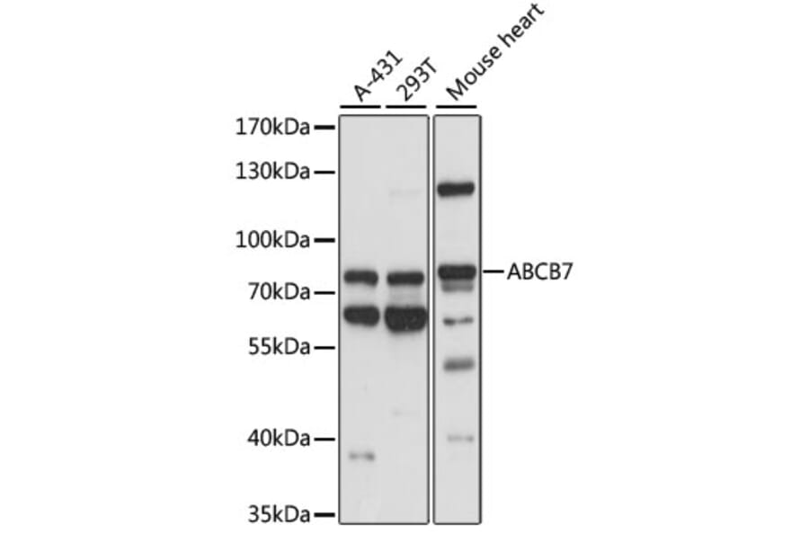 Western Blot - Anti-ABCB7 Antibody (A91323) - Antibodies.com